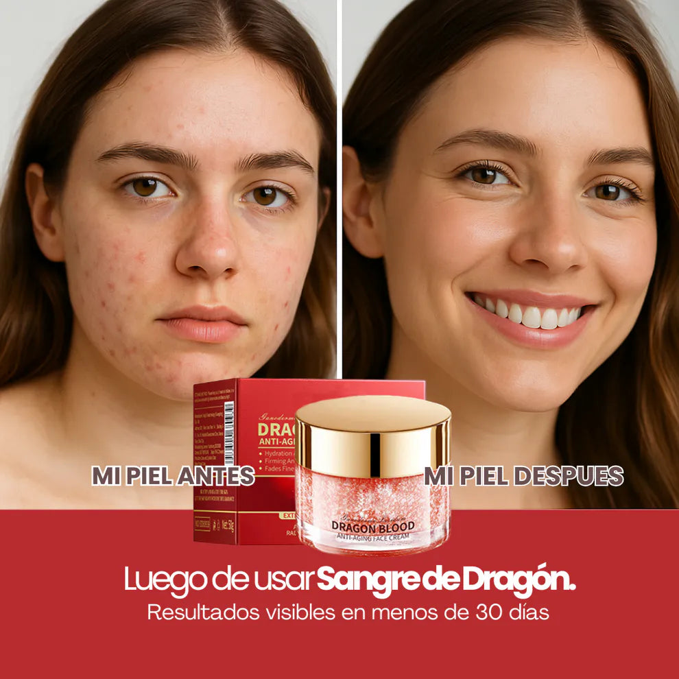 ¡10 Años Menos! Dragon's Blood - Crema Facial Rejuvenecedora